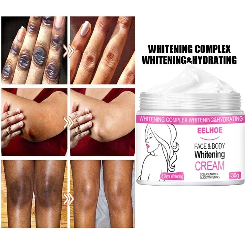 

Body Whitening Cream Effective Whiten Underarm Knee Dark Skin Remove Melanin Pigmentation Private Bleach Improve Dull Skin Care