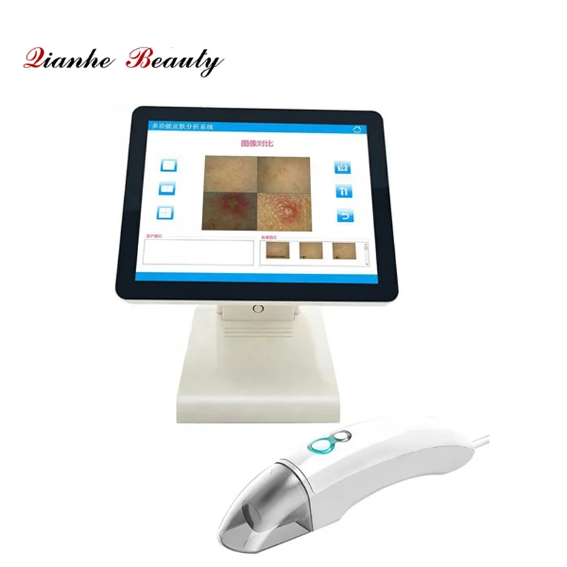 

Touch Screen UV Skin Scanner Analyzer