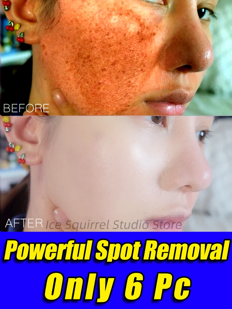 

Spot Removal Essence Remove Dark Spots Freckles Melasma Lighten Melanin Shrink Pores Anti Aging Blemish Removal