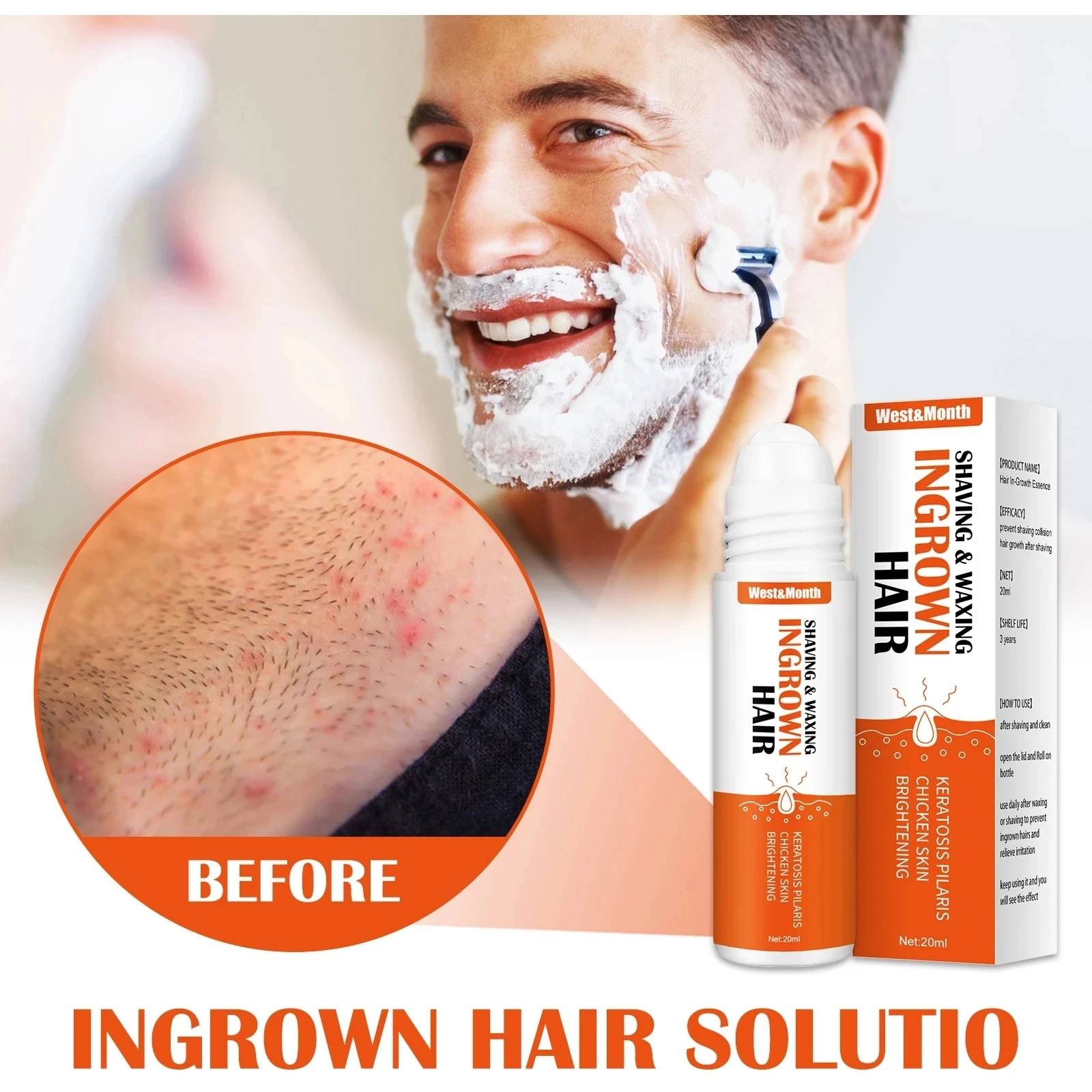 

20ml After Shave Repair Serum Solution Soothes Shaving Waxing Ingrown Hair Reduce Redness Soothes Skin Prevent Razor Bumps