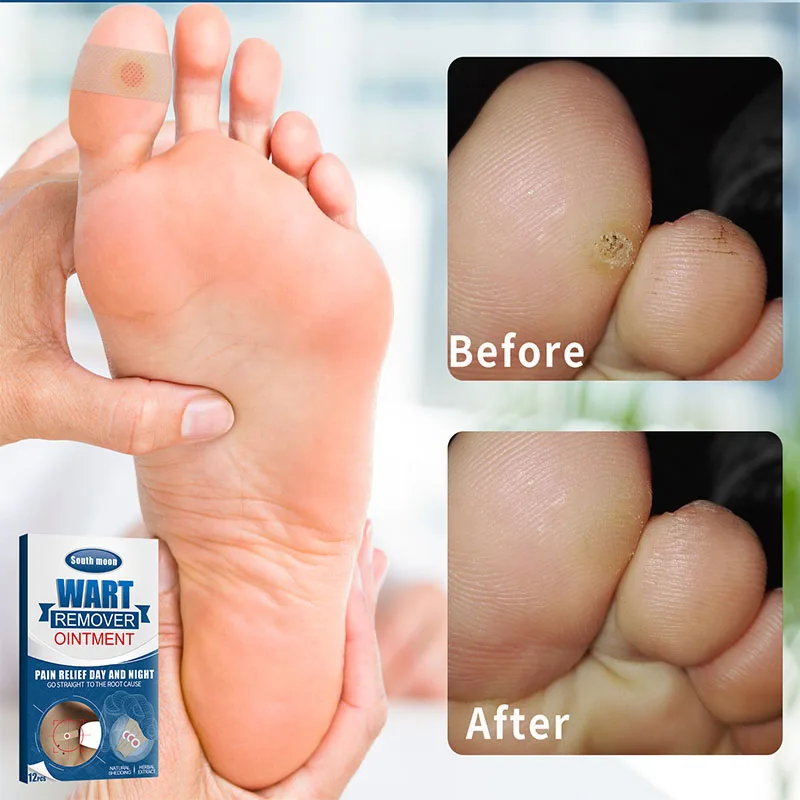 Этикетки для кожи средство удаления бородавок лечение этикетка веснушек и