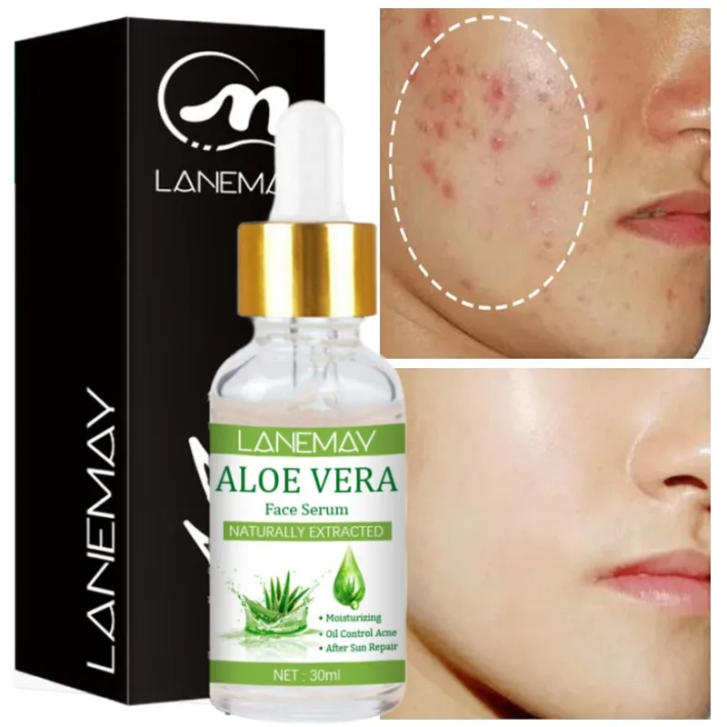

2023 New Aloe Vera Oil Free Serum Repair Sunburn Redness Acne Pore Shrink Light Melanin Hydrating Anti-Aging Essence Beauty Care