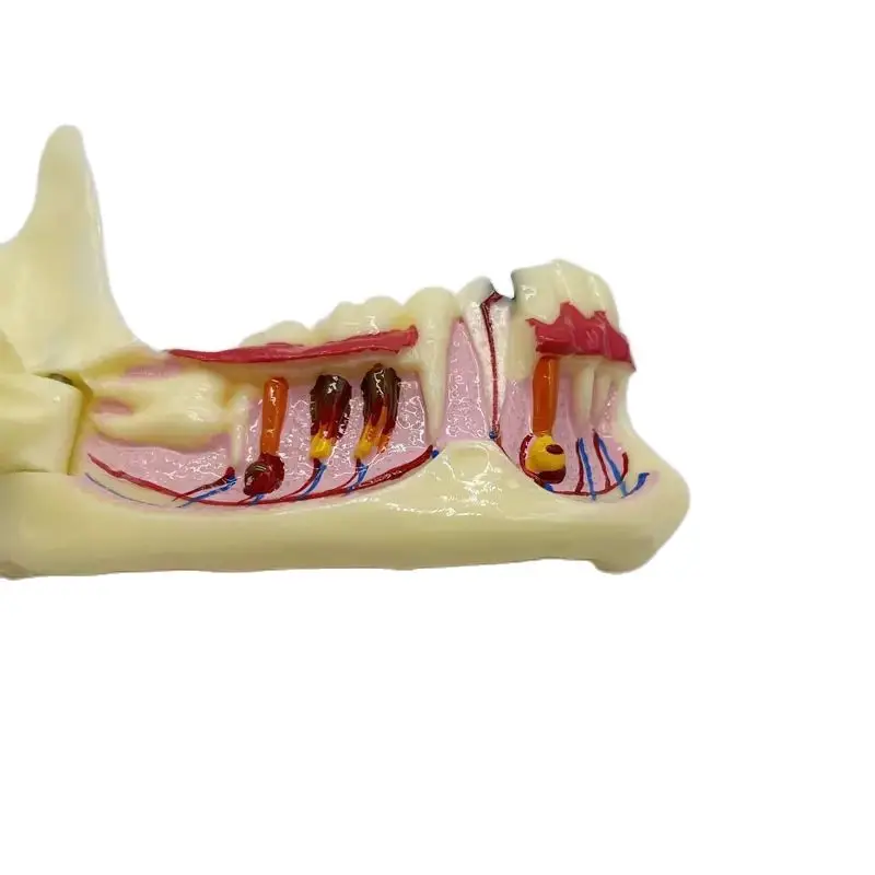 Мстительная стоматологическая обучающая модель структура зубов разложение