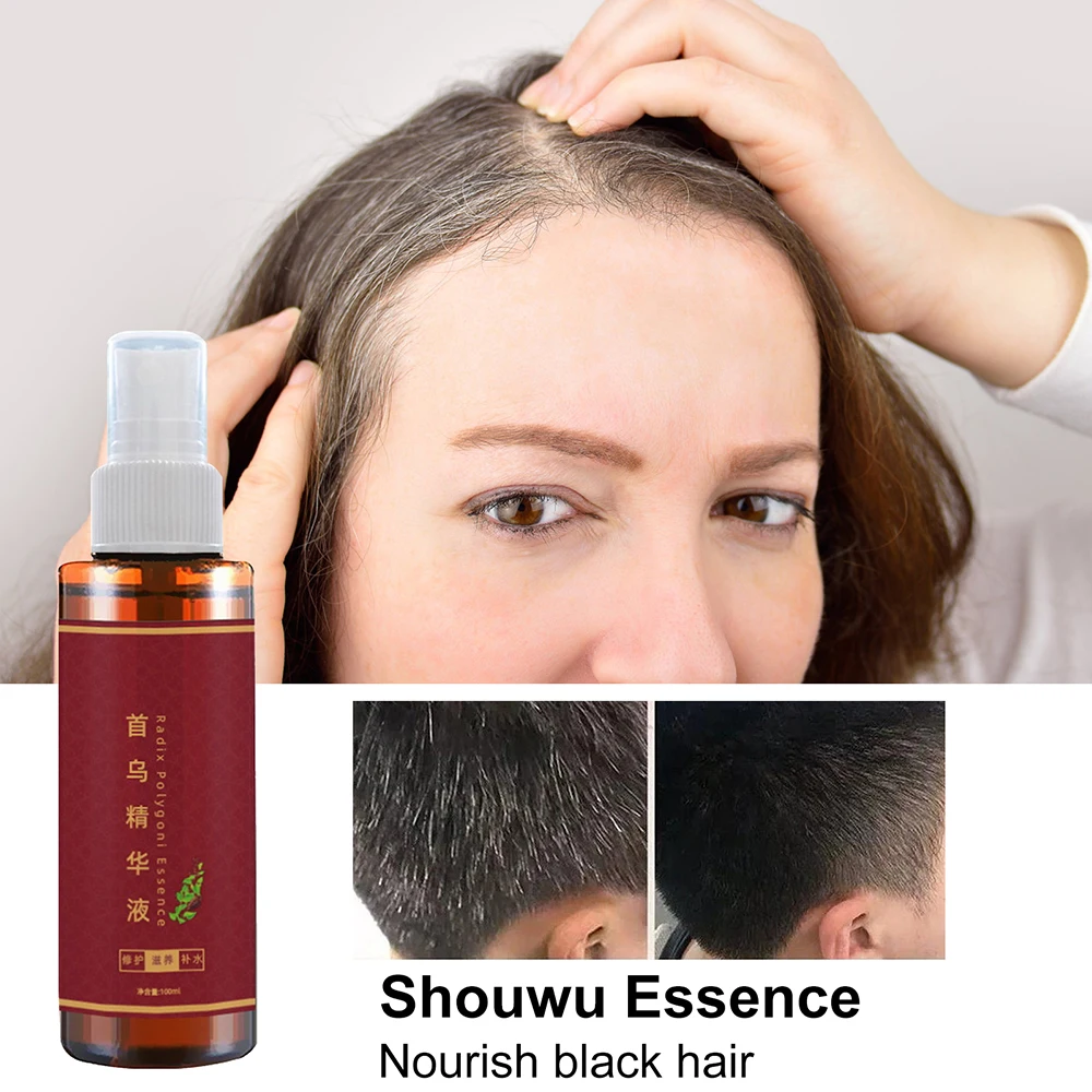 

Liquid Herbal Cure White Hair Treatment Spray Hair Growth Essence Oils Black Hair Oil Control Shampoo Moisturizing Hair 100ml