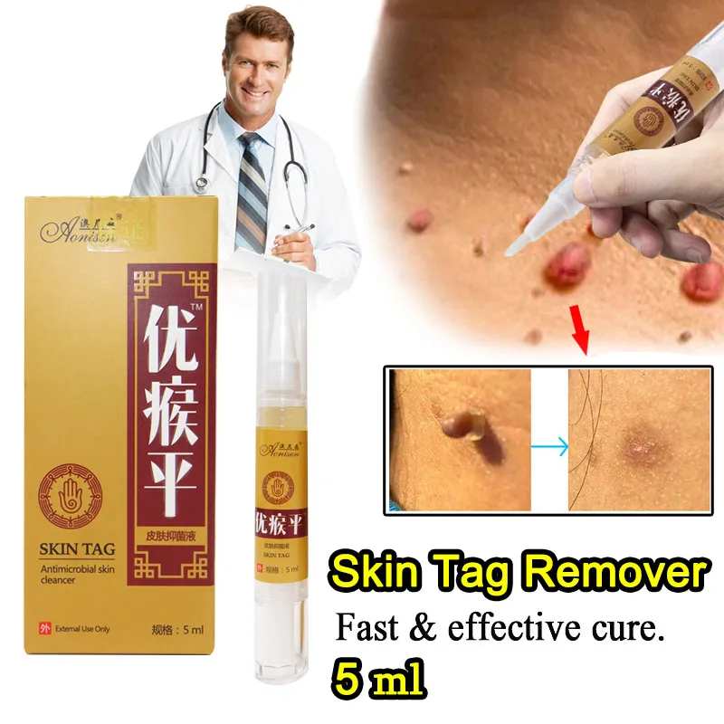 

Skin Tag Remover Against Mole & Genital Wart fast RemovWithin al Anti Foot Corn Removal Warts Papillomas Rapidly removes moles