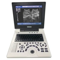 cheapest and affordable full digital black and white notebook veterinary ultrasound scanner factory price