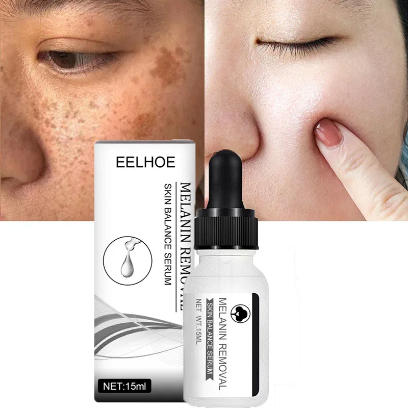 

Effective Whitening Freckle Face Serum Remove Dark Spots Melasma Melanin Shrink Pores Moisturizing Brightening Skin Care
