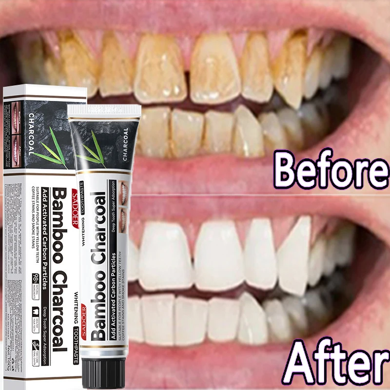 

Whitening Teeth Toothpaste Deep Cleaning Cigarette Stains Repair Bright Neutralizes Yellow Tones Dental Plaque Fresh Breath 100G