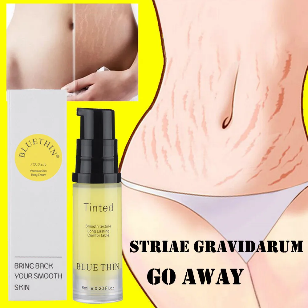 

Stretch mark cream reduces stretch marks after delivery 1pcs--6ml