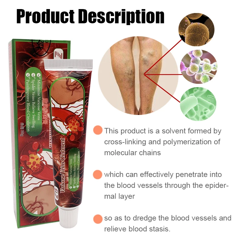 Травяная мазь для лечения флебита паука крем облегчения боли в венах улучшения