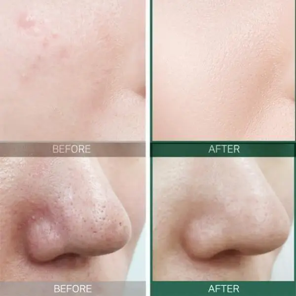 Some By Mi AHA-BHA-PHA 30 Days Miracle Toner - Кислотный очищающий тонер для проблемной кожи 150мл |