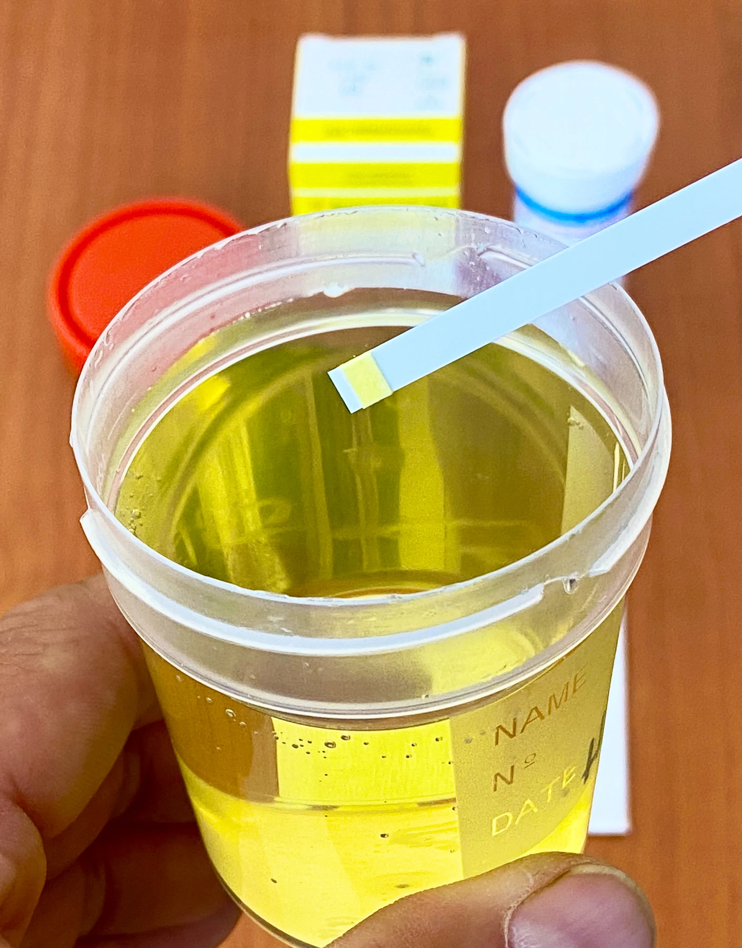 Тест-полоски для определения гемоглобина в моче &quotУриполиан -1 he&quot (Уригем) №50 |