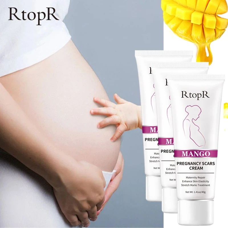 RTOPR Mango Remove Pregnancy Scars Acne Cream Stretch Marks Treatment Maternity Repair Anti-Aging Anti Winkle Firming Body Cream