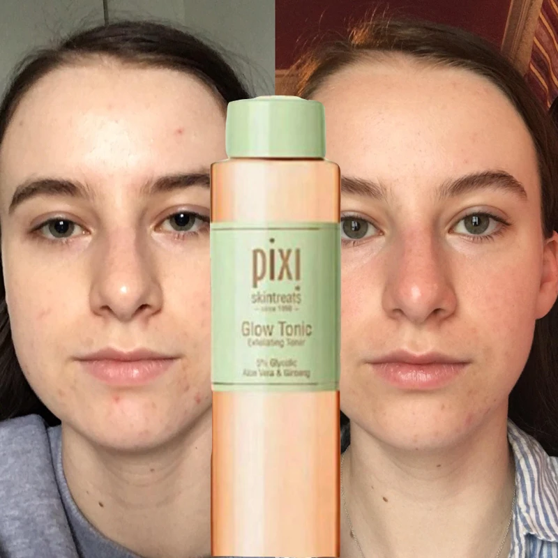 

Pixi 5% Glycolic Acid Glow Tonic Moisturizing Oil-controlling Anti-acne Essence Women Face Skin Care Exfoliation Toner 100ml