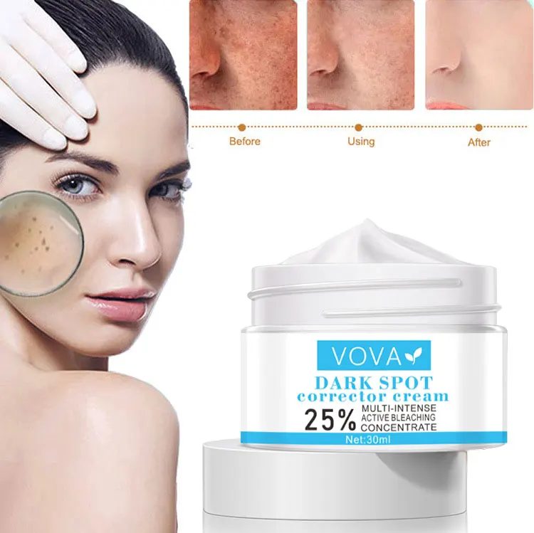 

Effective Whitening Freckle Cream Remove Melasma Acne Spot Pigment Melanin Dark Spots Pigmentation Moisturizing Gel Skin Care