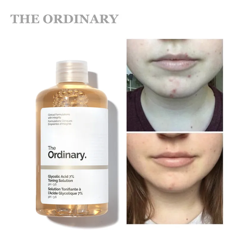 

Ordinary Toner Glycolic Acid 7% Toning Solution Exfoliation Deep Cleansing Pores Removal Acne Treatment Skin Care 240ml