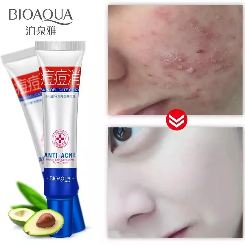 Bioaqua Концентрированный крем от прыщей и акне точечного действия skin delicate silky 30мл |