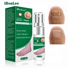 Эссенция iBeaLee для восстановления ногтей от грибков, сыворотка для лечения грибка ногтей, средство против инфекции, паронихия и онихомикоз