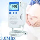 Допплер фетальный бытовой, 3,0 МГц, без радиации