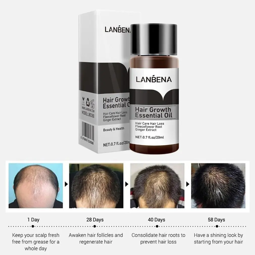 Hair Growth Essential Oil Care 20ml Liquid Loss Treatment Promote | Красота и здоровье