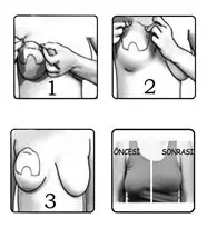 

Gs Dzenleyici Toparlayc Dikletirici Bant Gs Band 25 ift