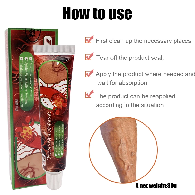 Травяная мазь для лечения флебита паука крем облегчения боли в венах улучшения
