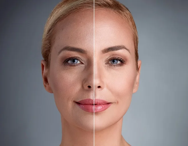 

Lifecell Collagen Cla Urw066 prevents cellulite acne wrinkle skin renewal protein muscle energy aging 30 ase