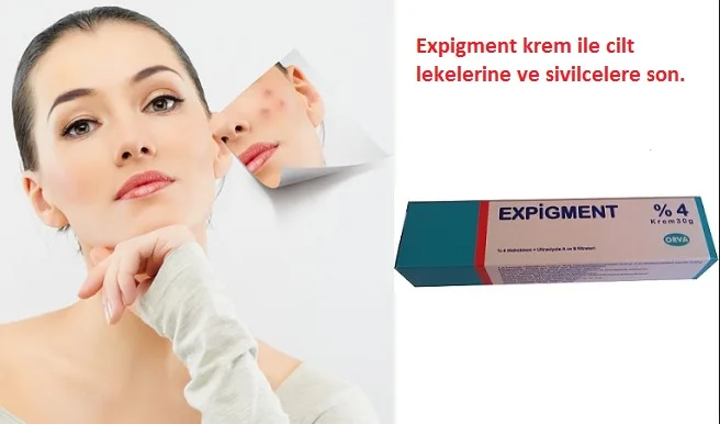 Expigment 30 г 1 унций гидрохинон 4% крем для отбеливания кожи Осветление кожи Melasma