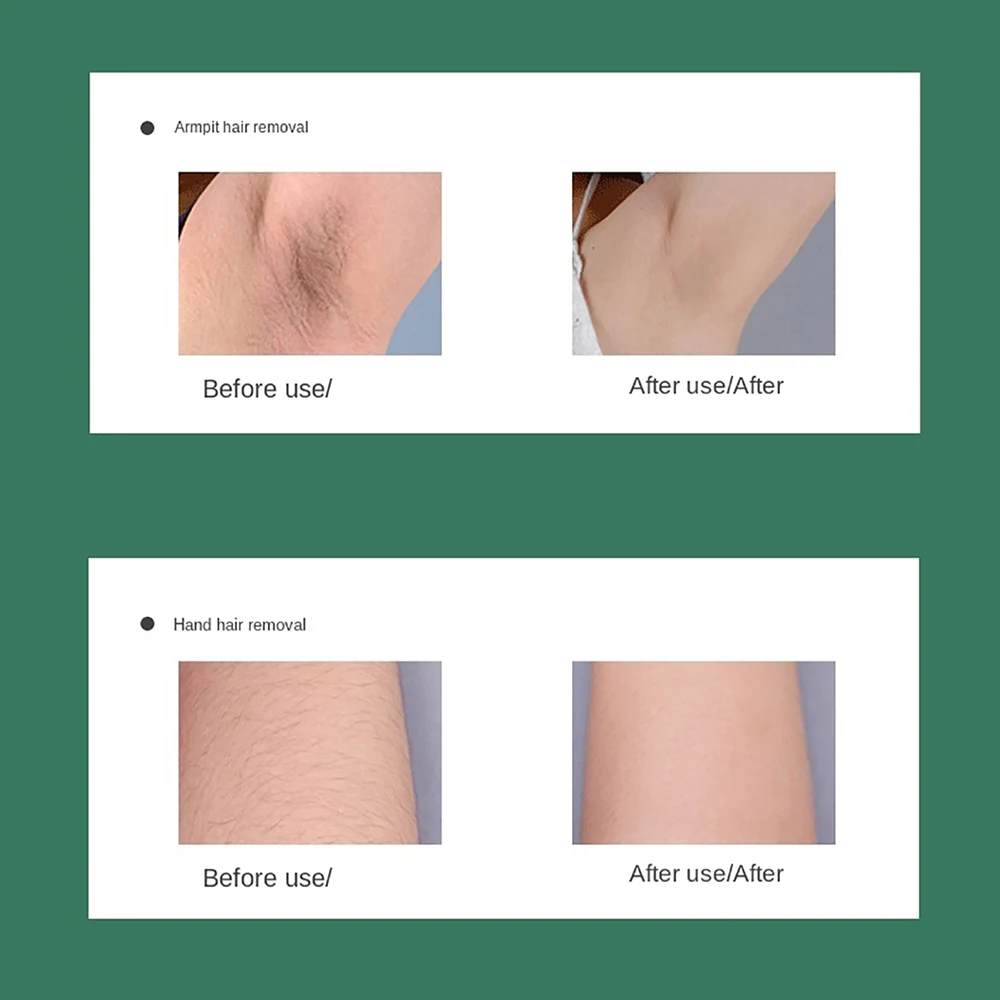 999999 мини-вспышка лазерный эпилятор IPL Удаление волос для женщин на всем теле