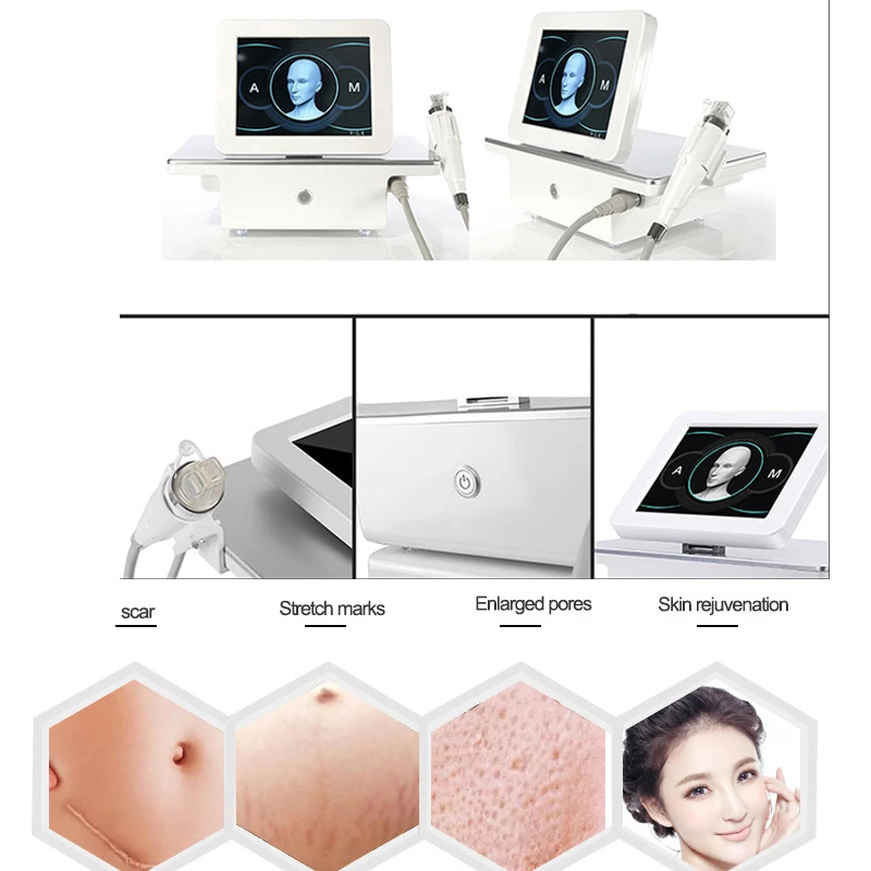 Skin lifting anti-wrinkle acne scar stretch marks removal partial rf machine microneedle microneedling beauty machine