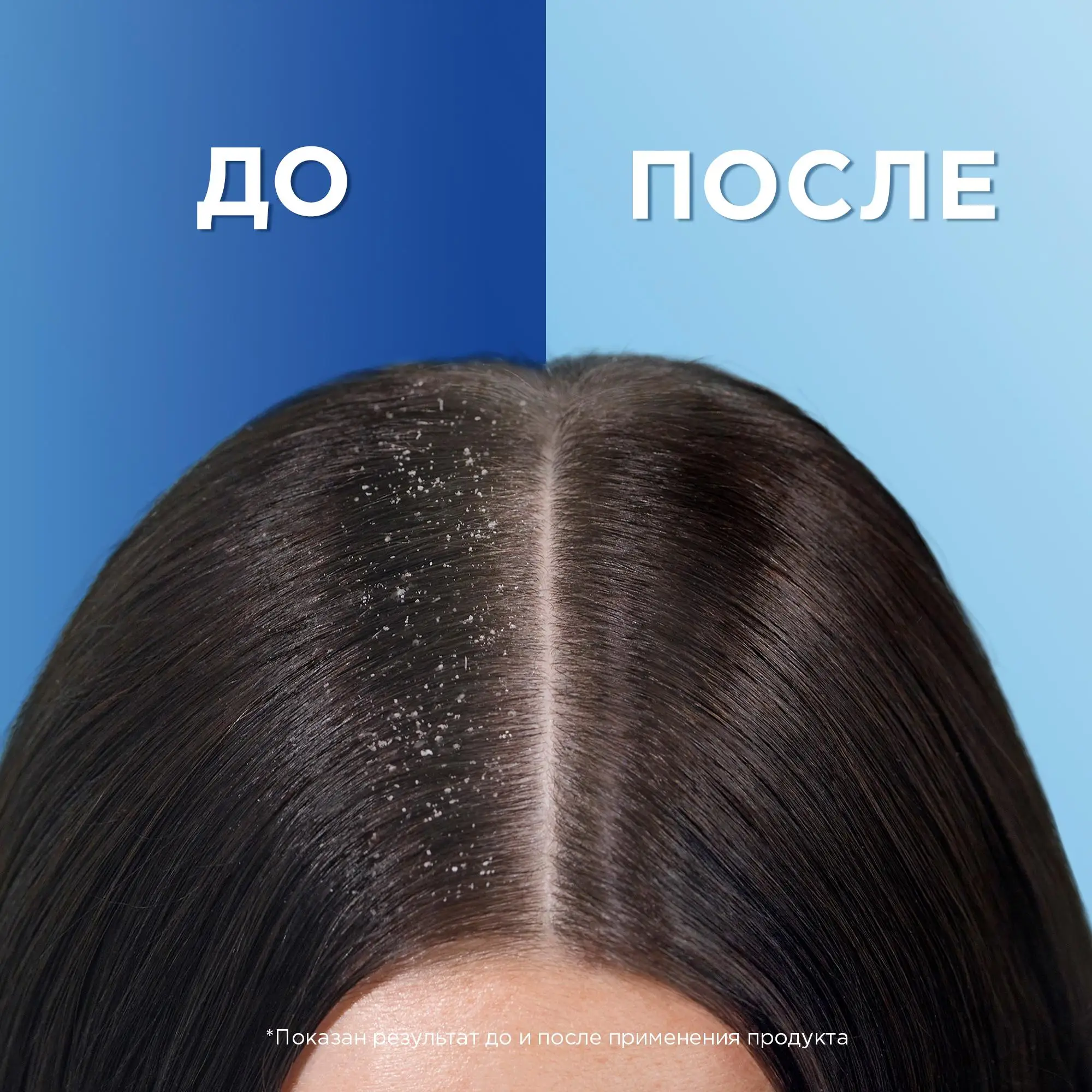 Шампунь против перхоти Head & Shoulders цитрусовая свежесть 600 мл | Красота и здоровье