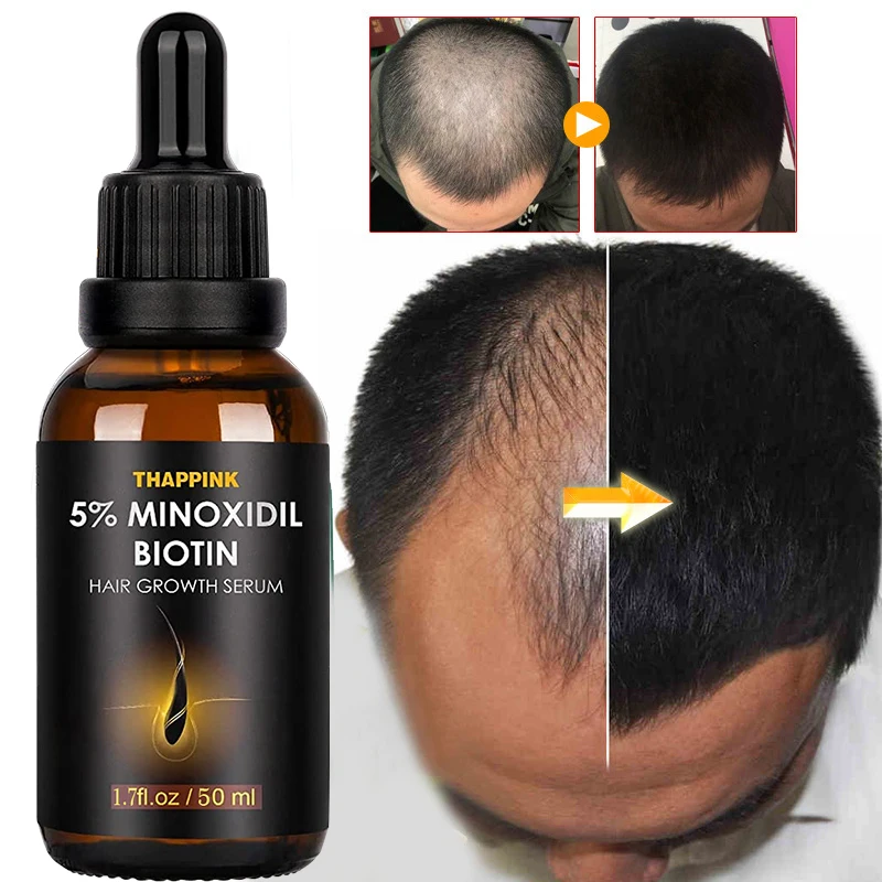

Promote Hair Growth oil Products Ginger Anti Hair Loss Serum Treatment Hair Dying Perm Dry Frizzy Damaged Thinning Hair Care