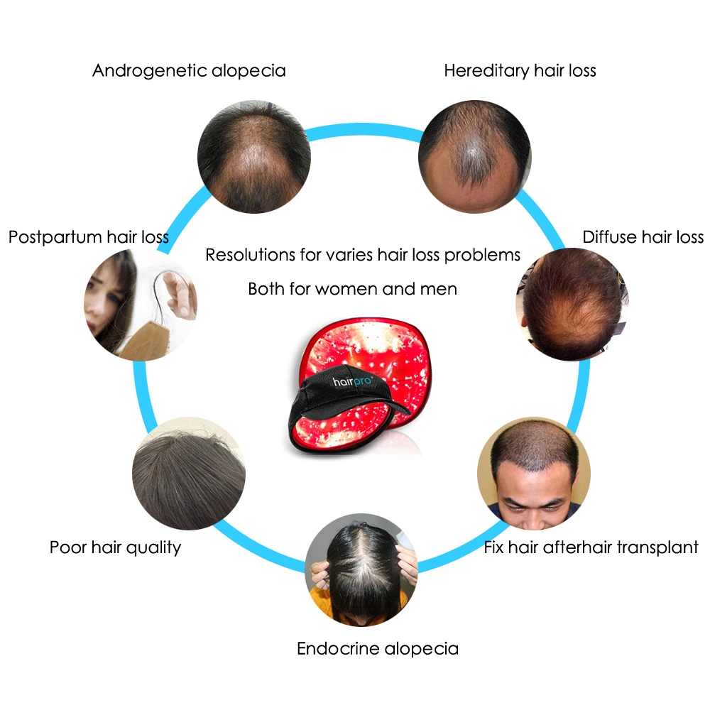 Лазерная Кепка для роста волос мужчин и женщин шлем расческа восстановления уход