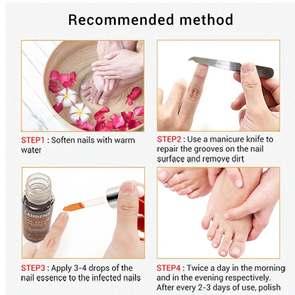 Лечение грибка для ногтей LANBENA с пилкой против гриба удаление онихомикоза Уход за