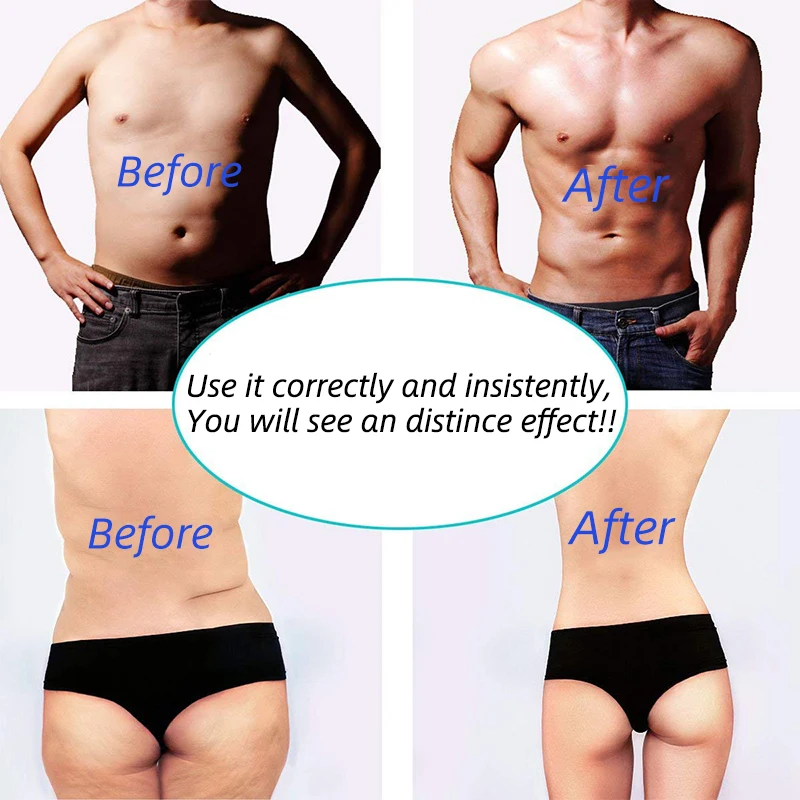 EMS стимулятор мышц электростимулятор электроды Электрический Антицеллюлитный