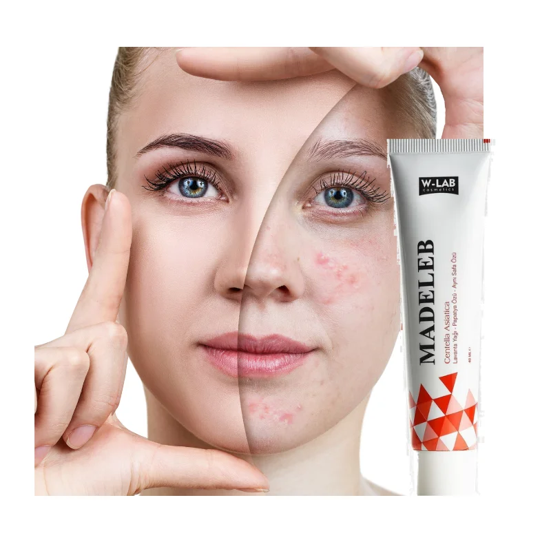 

Madeleb W-Lab Skin Renewal Cream 40 Ml Skin Wounds Psoriasis Eczema Acne Problems Cell Regeneration