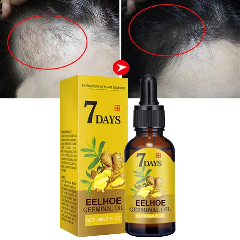 

Ginger Hair Growth Serum Fast Growing Hair Essential Oil Prevent Hair Loss Thinning Dry Frizzy Damaged Repair Hair Care Products