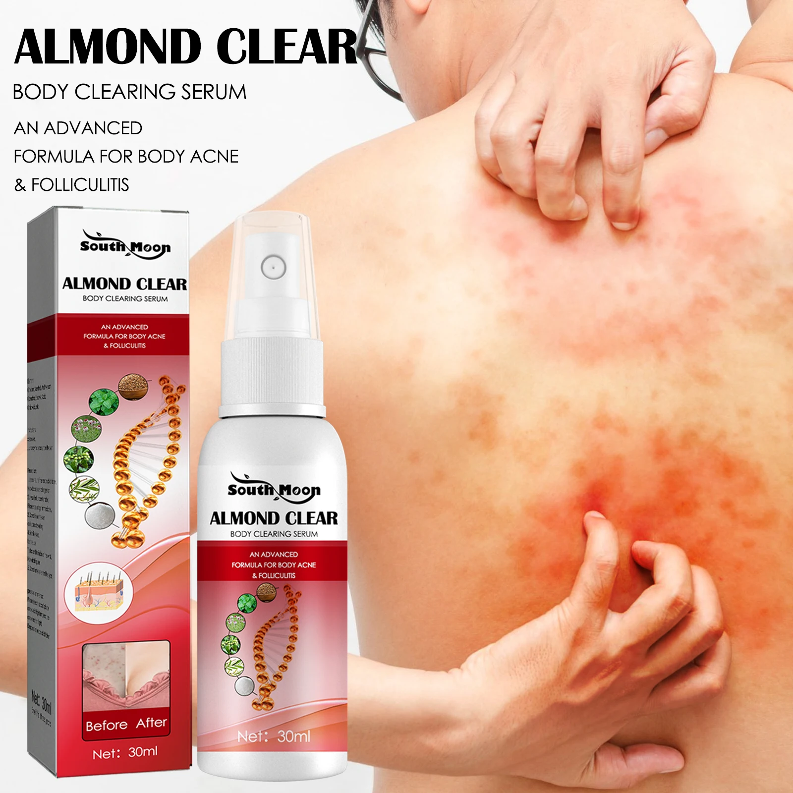 Body Clearing Serum Antifunga Body Acne Folliculitis Back Butt Shoulders Mandelic Acid Antibacteri