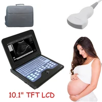 cms600p2 portable ultrasound scanner laptop machine ultrasonic systems with 3 5 mhz convex probe ce fda