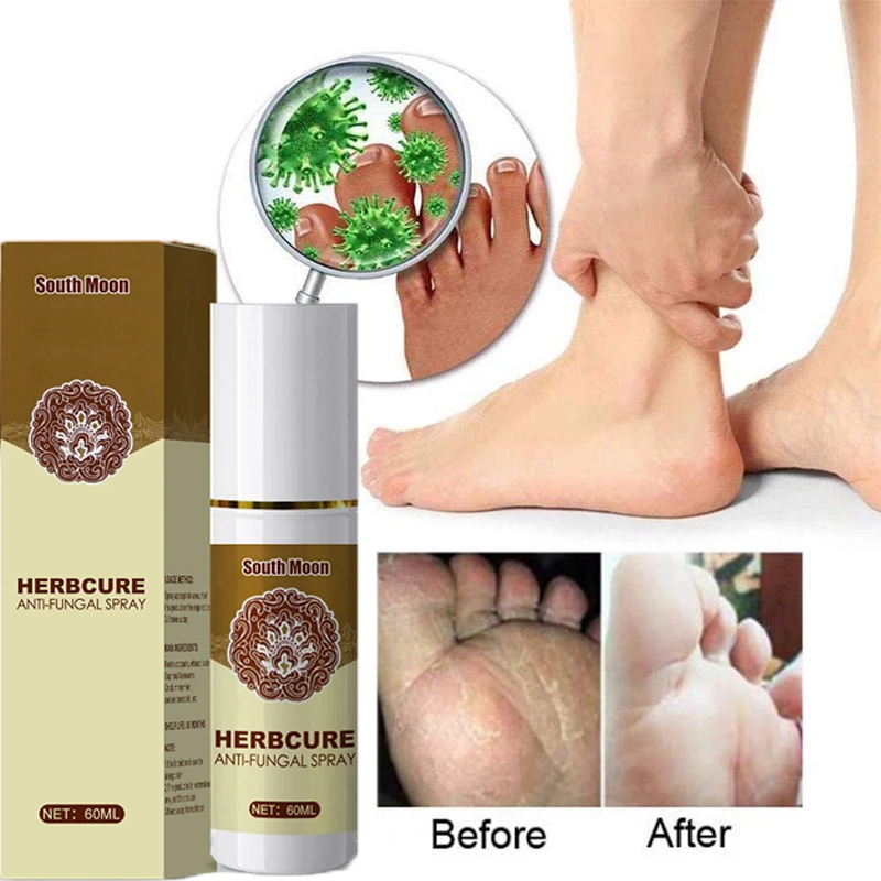 

60ml Instant Athlete's Foot Spray Herbal Itching Anti-fungal Sweat Odor Feet Care Liquid Relieve Beriberi Remove Fungus Products