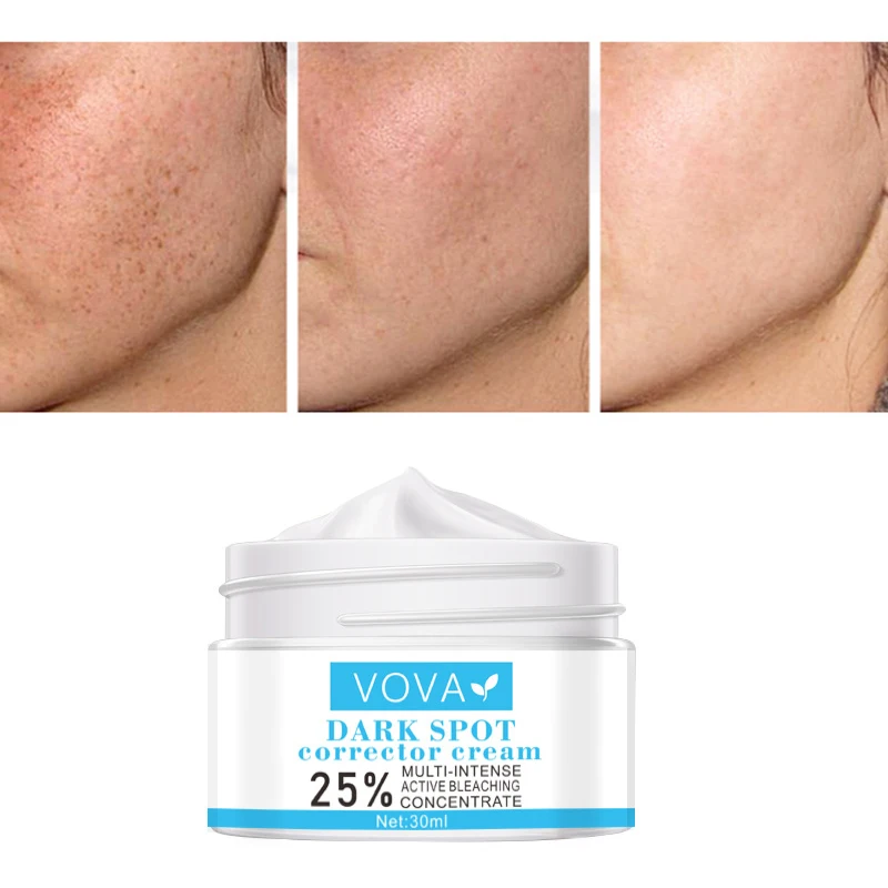 

VOVA 30ml Effective Remove Melasma Acne Spot Pigment Melanin Dark Spots Pigmentation Whitening Freckle Cream Moisturizing Gel