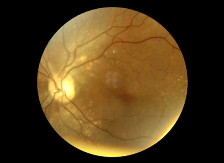 Портативная портативная немидрическая Скрытая камера с бесплатной доставкой FDA |