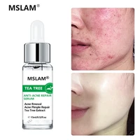 tea tree anti acne face serum effective acne removal fade acne mark scar repair essence oil control moisturizing care cosmetic