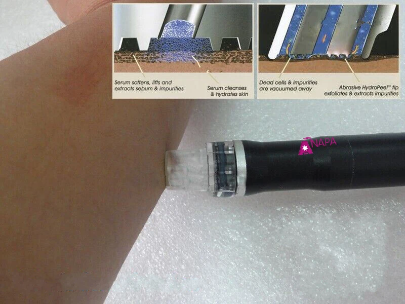 Hydra Dermabrasion Repalcement Wand&ampTips Use For Hydrate dermabrasion Peeling Machine |