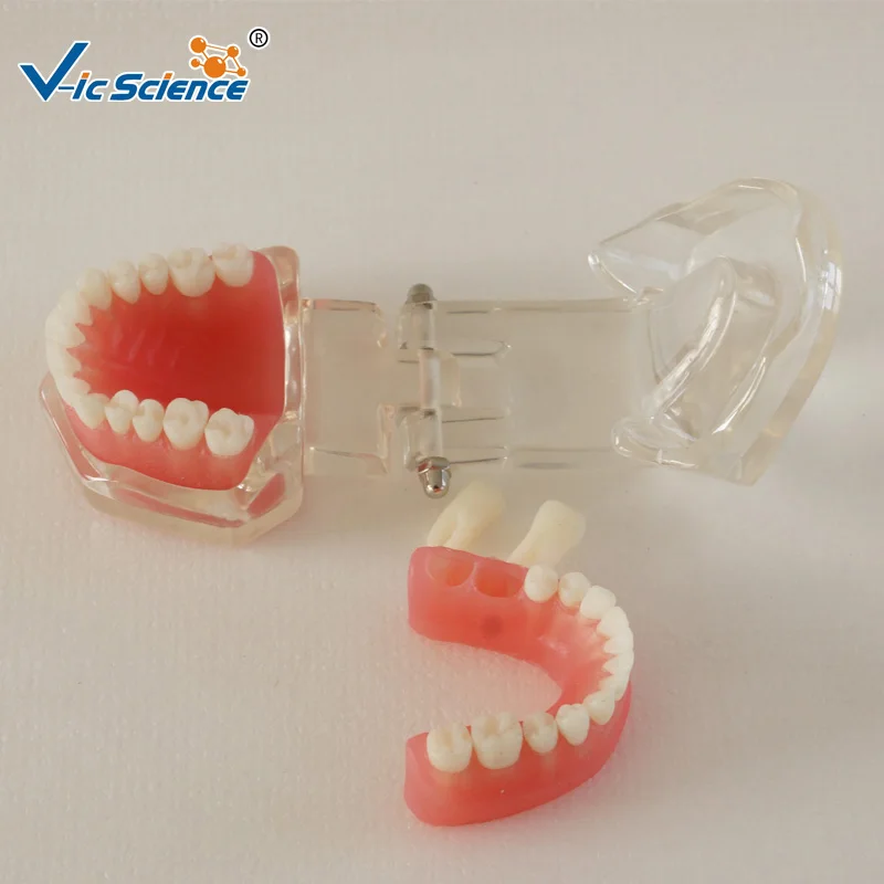 28 шт Стандартный Полный рот мягкая резинка съемные зубы модель|teeth model|teeth mouthteeth gum