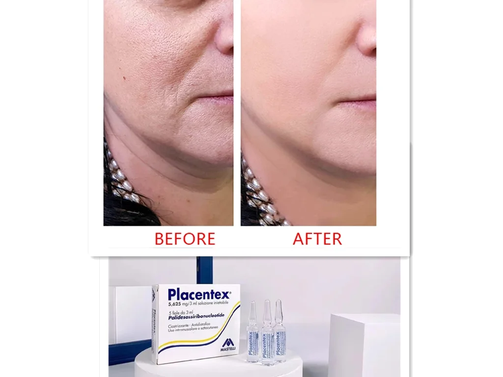 

1box placentex Age Anti-Wrinkle Increase Collagen Productio
