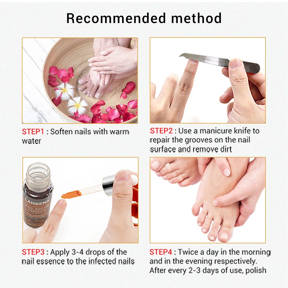 

LANBENA Nail Fungal Treatment Feet Care Essence Removal Fungus Healthy Repair Serum Anti Infection Paronychia Onychomycosis
