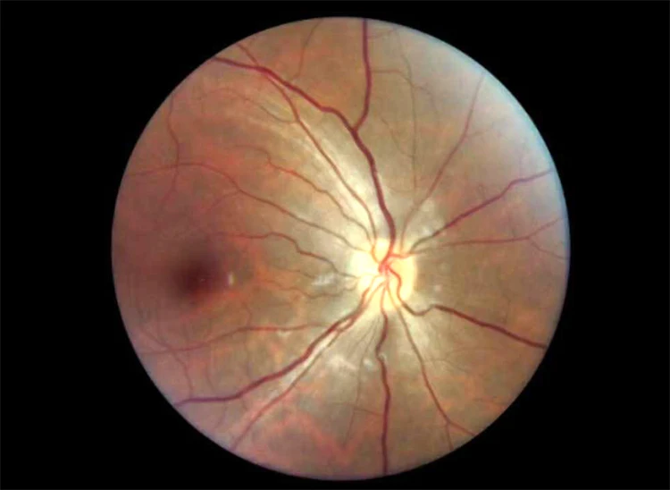 Портативная портативная немидрическая Скрытая камера с бесплатной доставкой FDA |