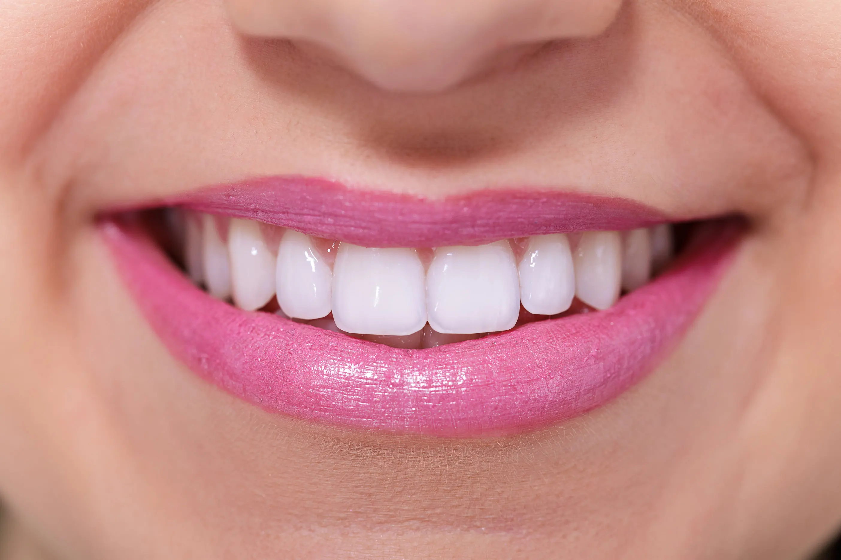 Аккуратнее зубы. Идеальные зубы. Красивые ровные зубы. Красивая форма зубов у женщин.