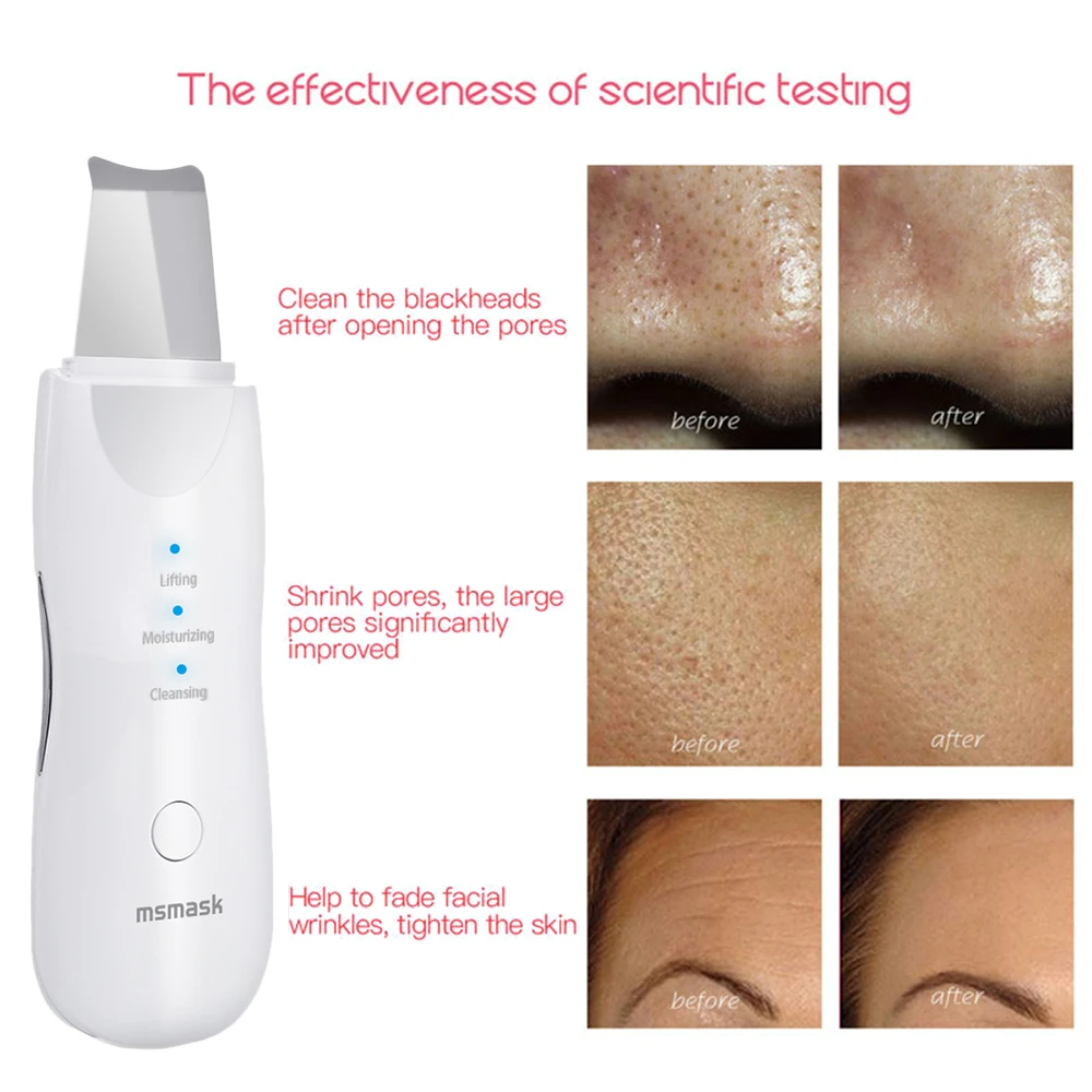 Ультразвуковое устройство для очистки лица очистка кожи очищение омертвевшей